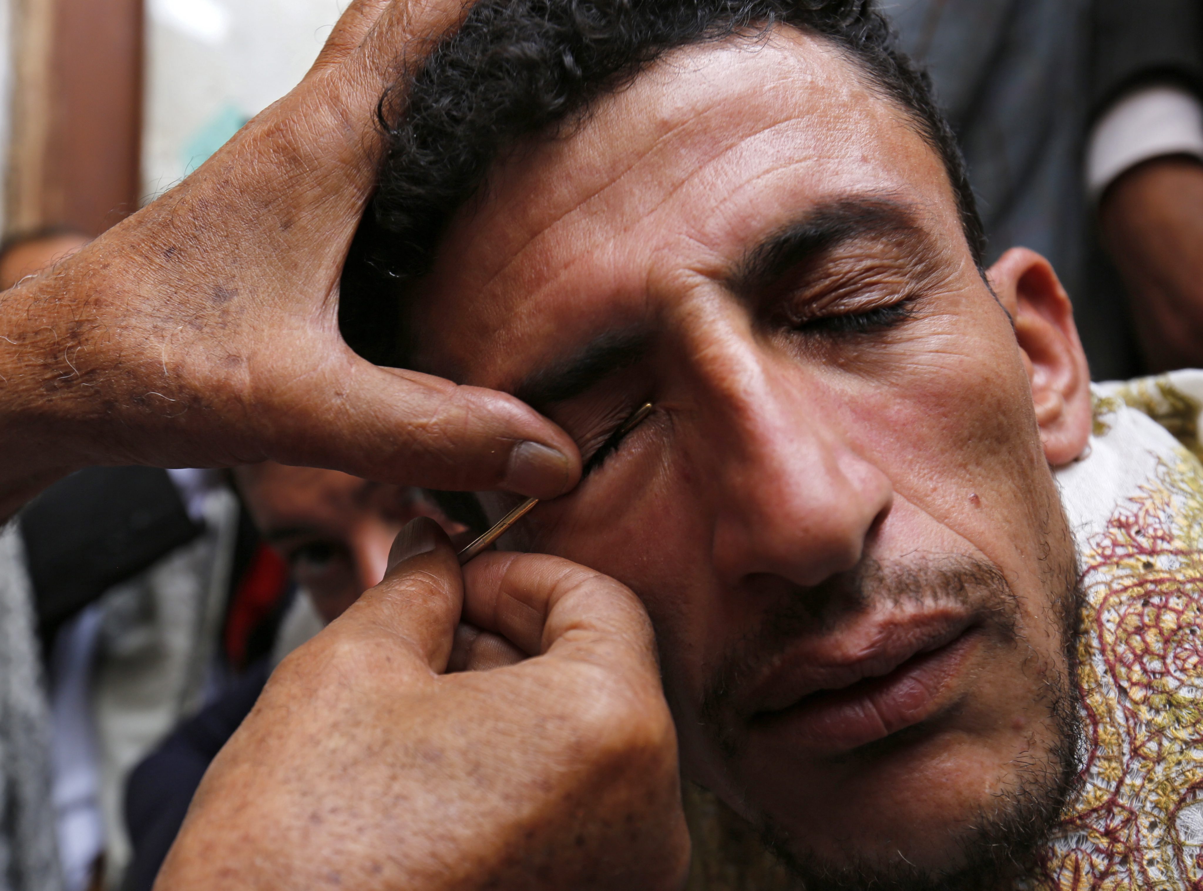 Hier brengt een expert kohl aan op de oogleden van een Jemitische moslim in Sana'a. Kohl wordt in het Midden-Oosten gebruikt om oogziekten tegen te gaan tijdens de vastenmaand.